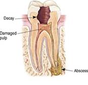 Endodontic Specialist of Oakhurst